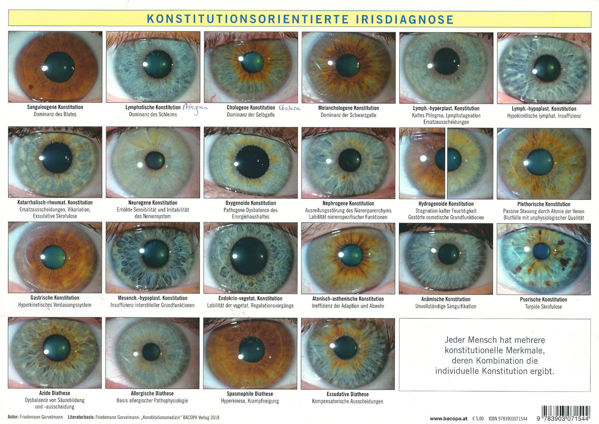 Fotos Iriden - Chart Konstitutionsorientierte Irisdiagnose